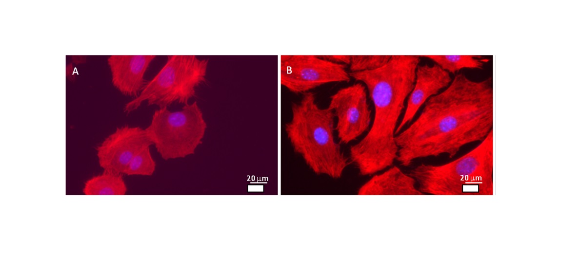 Logran mejorar la respuesta del cuerpo humano a los implantes
