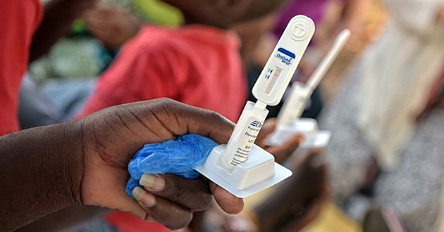 Un estudio internacional analiza las variantes del virus VIH en el mundo y su evolución