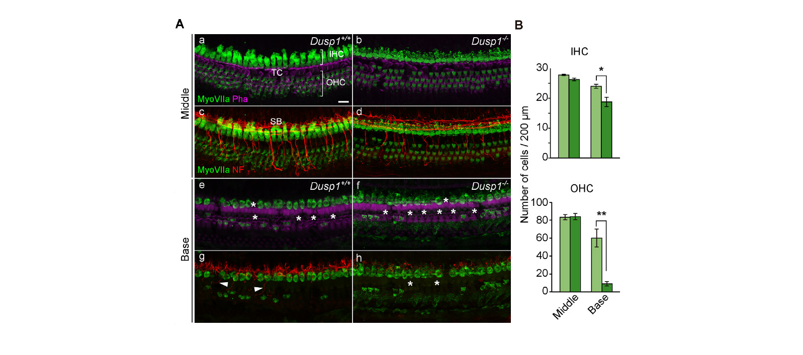 La deficiencia en DUSP1 acelera la pérdida auditiva asociada al envejecimiento