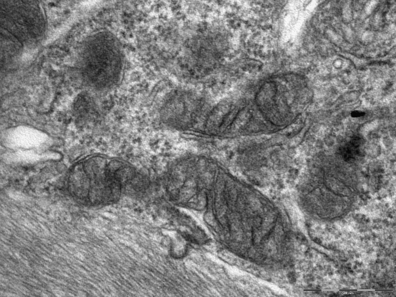 Desarrollan un modelo experimental para el estudio de un tipo de atrofia humana del nervio óptico