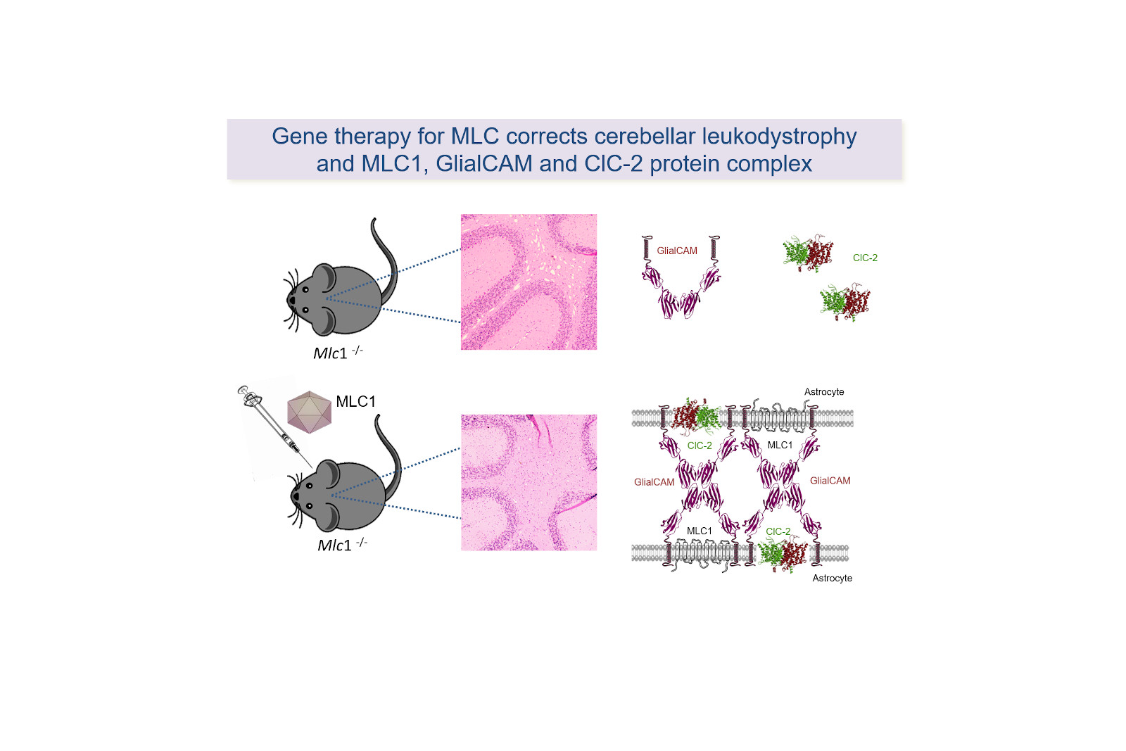 Ofrecen una primera aproximación de terapia génica para la enfermedad MLC en modelos preclínicos
