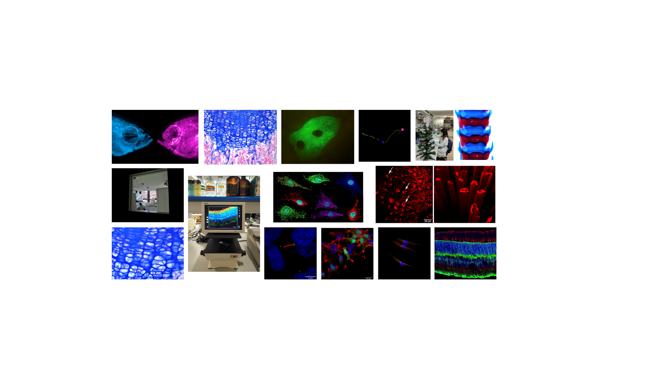 ‘Fish-to-Face’ y ‘Mitochondrial rainbow’, ganadoras del Concurso CIBERER de fotografía sobre investigación en enfermedades raras