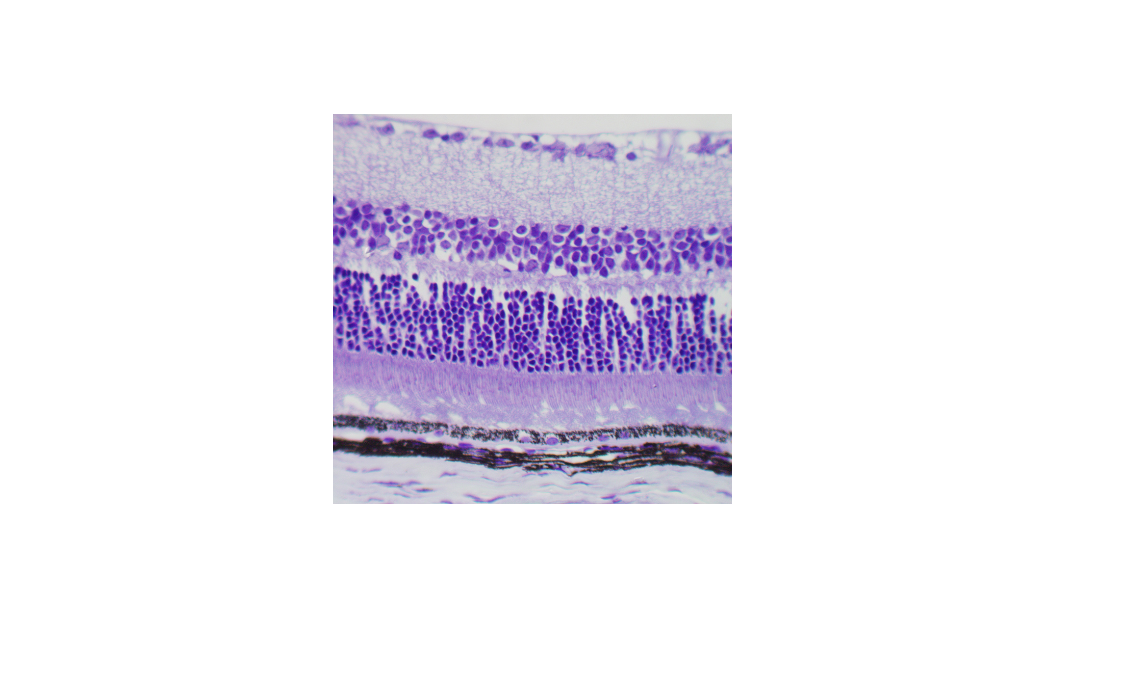 Revisan el papel de la vía de pigmentación de la retina en el albinismo humano