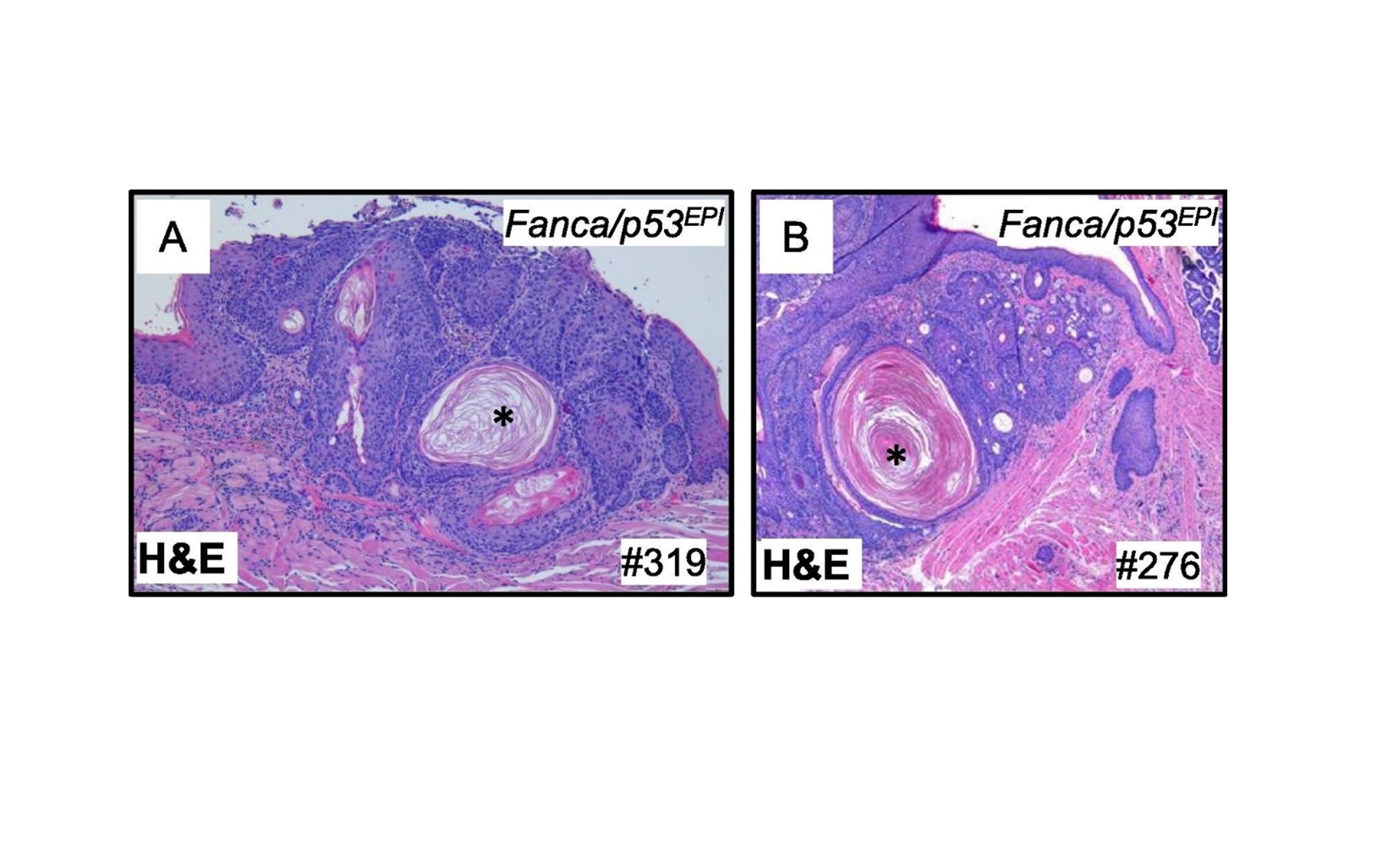 Publican el primer modelo de ratón de carcinomas escamosos de cabeza y cuello en anemia de Fanconi