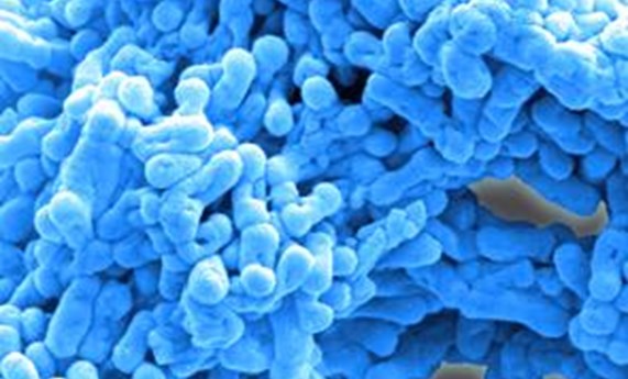 Nuevas vacunas contra la tuberculosis Nuevas vacunas contra la tuberculosis