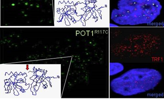 Identifican un gen responsable de las formas familiares de angiosarcoma cardiaco Identifican un gen responsable de las formas familiares de angiosarcoma cardiaco