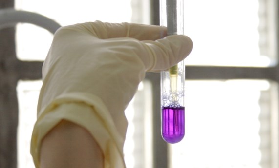 El CIBERER concede ayudas a dos proyectos de investigación traslacional en los que colaboran diversas unidades y grupos clínicos vinculados El CIBERER concede ayudas a dos proyectos de investigación traslacional en los que colaboran diversas unidades y grupos clínicos vinculados