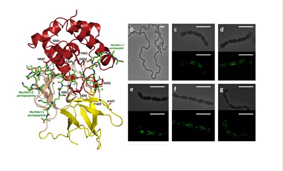 Caracterizan en profundidad la proteína LytB de neumococo Caracterizan en profundidad la proteína LytB de neumococo