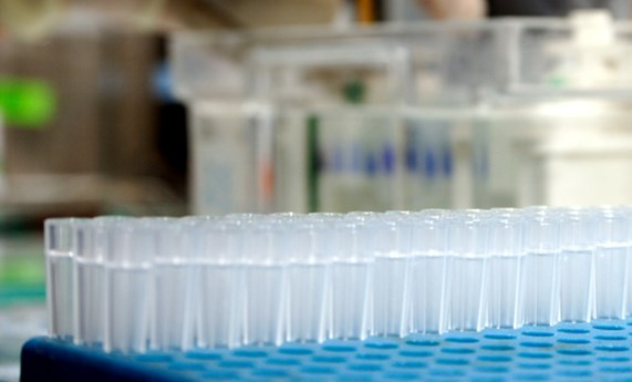 La convocatoria de ACCI 2015 del CIBERER financiará 11 proyectos de investigación La convocatoria de ACCI 2015 del CIBERER financiará 11 proyectos de investigación