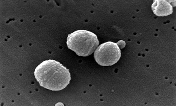 Un nuevo método para detectar neumococos ha obtenido la concesión de una patente en Estados Unidos Un nuevo método para detectar neumococos ha obtenido la concesión de una patente en Estados Unidos