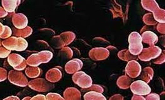 Demuestran que la bacteria de la neumonía también puede invadir el corazón Demuestran que la bacteria de la neumonía también puede invadir el corazón