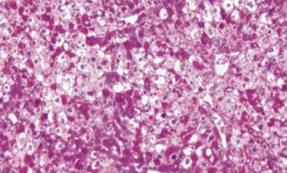 Descubren que hígado y cerebro se comunican para regular el apetito Descubren que hígado y cerebro se comunican para regular el apetito