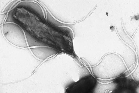 Se publica el consenso para optimizar el tratamiento de la bacteria 'Helicobacter pylori', que afecta a la mitad de la población española