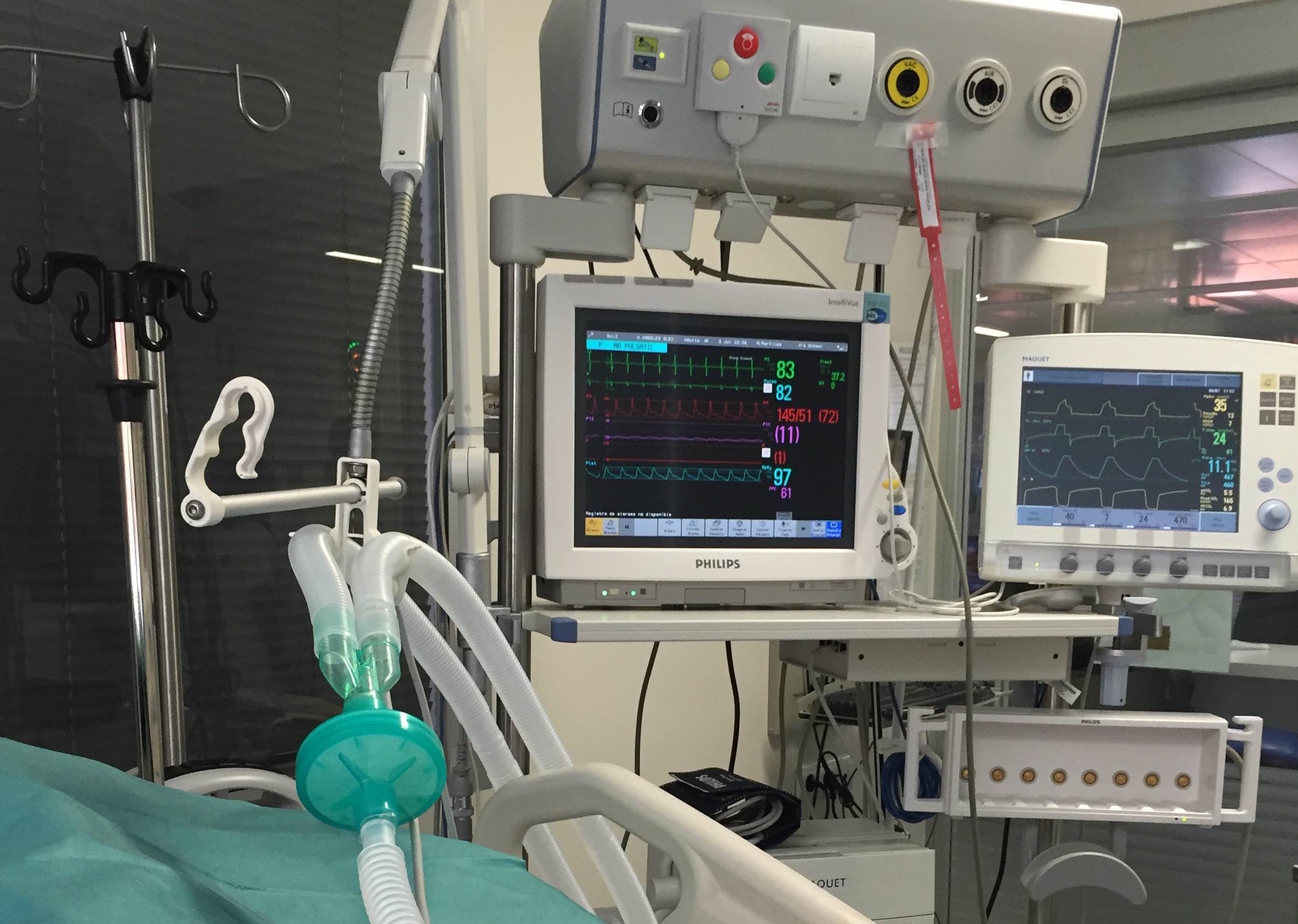 Diseñan un sistema de uso sencillo para predecir el pronóstico de pacientes con lesión pulmonar grave