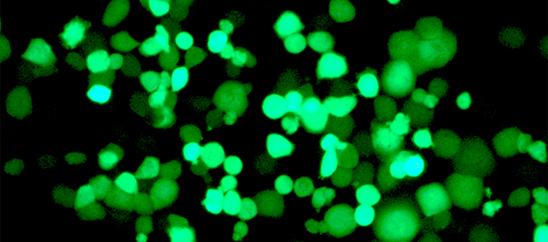 Crean virus que atacan de forma selectiva a las células tumorales